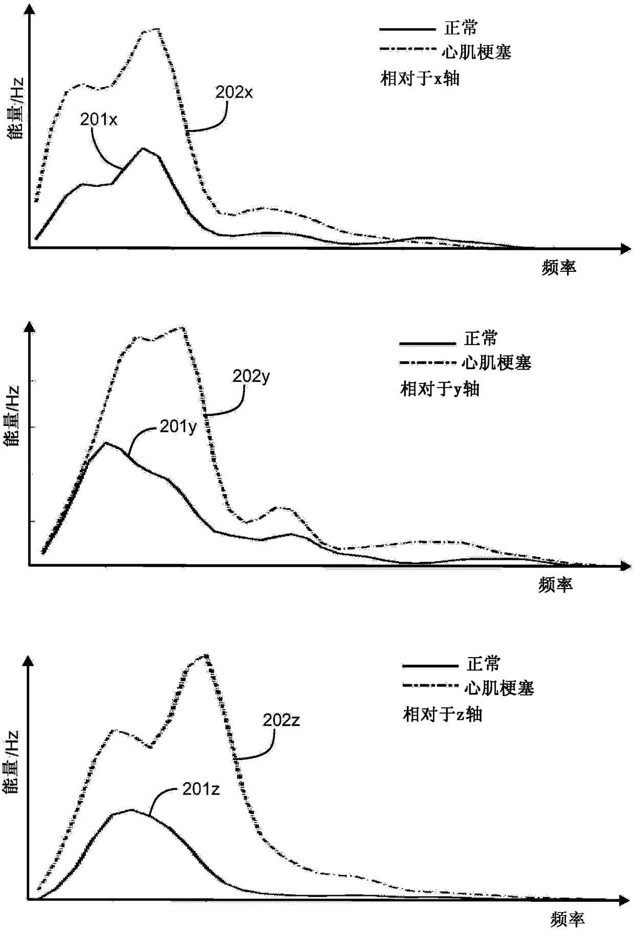 Method and apparatus for producing information indicative of cardiac condition