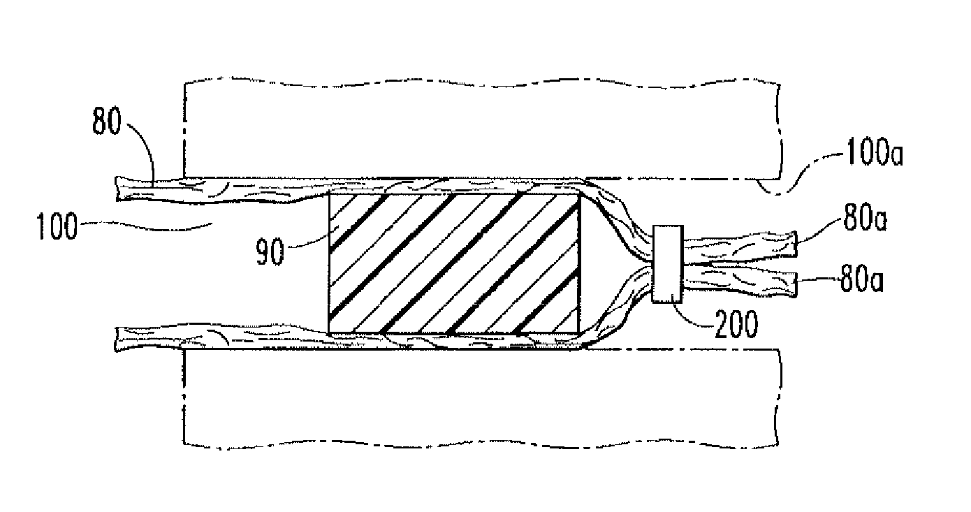 Graft Fixation