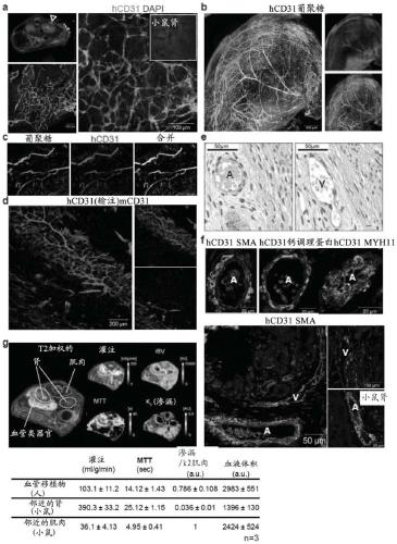 Blood vessel organoid, methods of producing and using said organoids