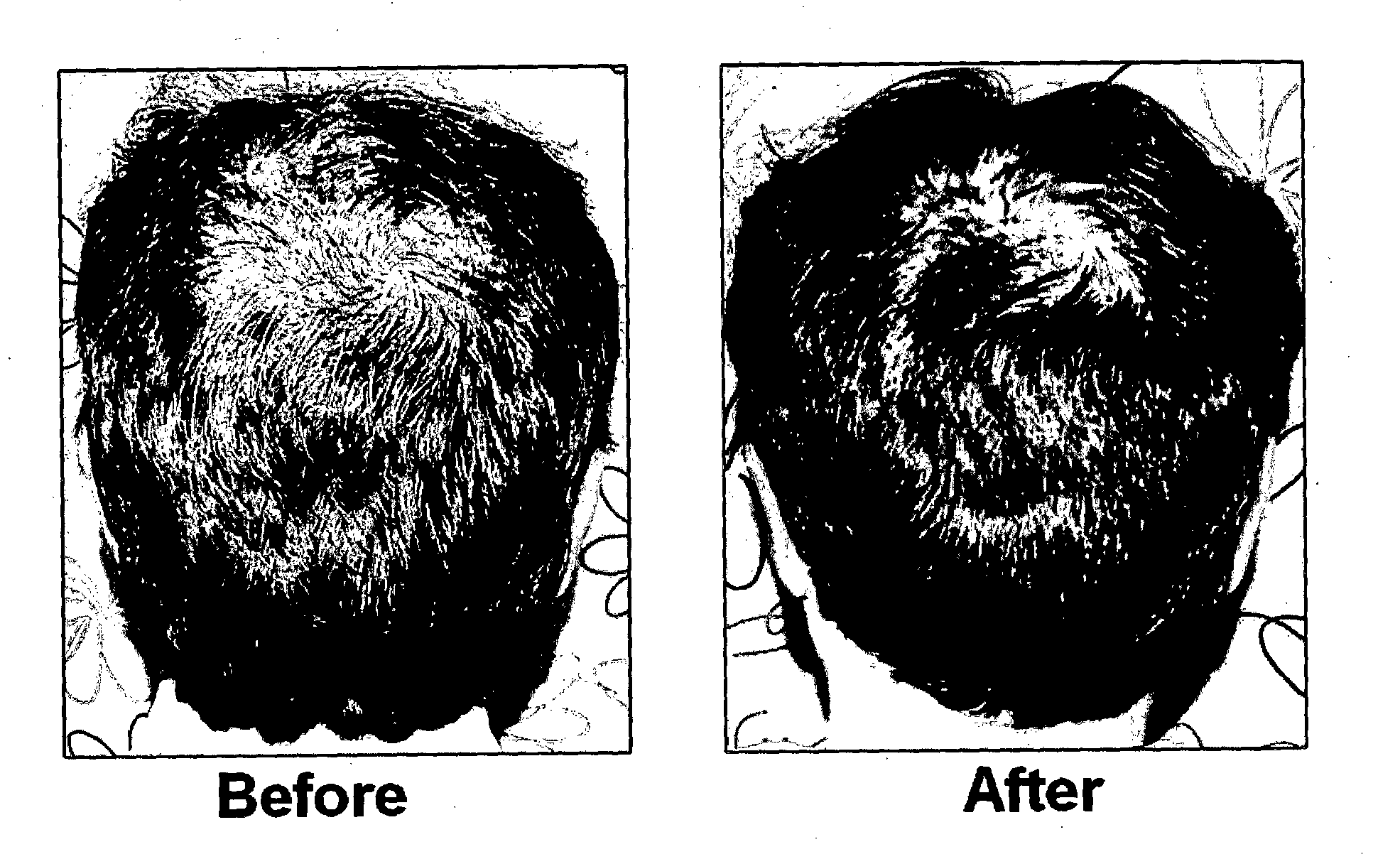 Method of preparing a growth factor concentrate derived from human platelets