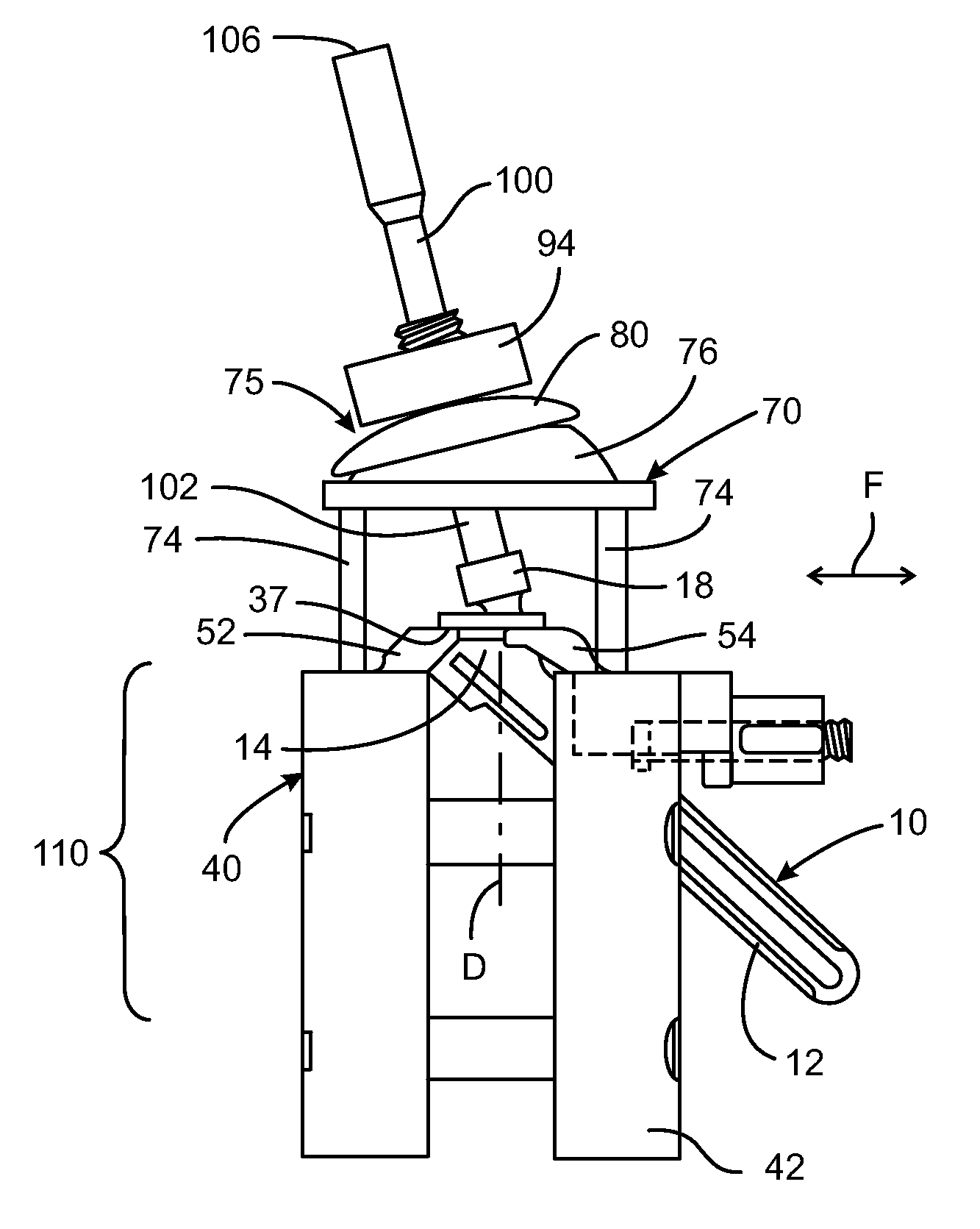 Instrumentation for recording and replicating orthopaedic implant orientation