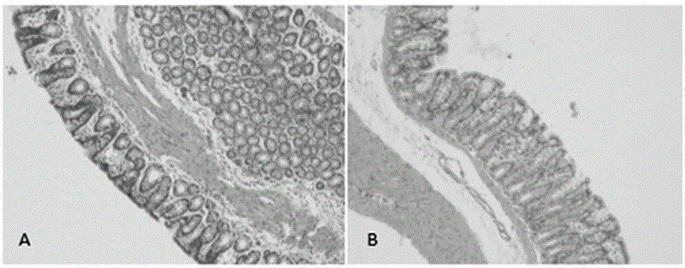 Improved SD (Sprague Dawley) rat CD (Crohn's Disease) modeling method