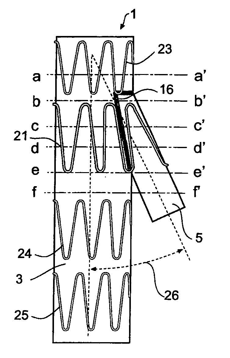 Side branch stent graft