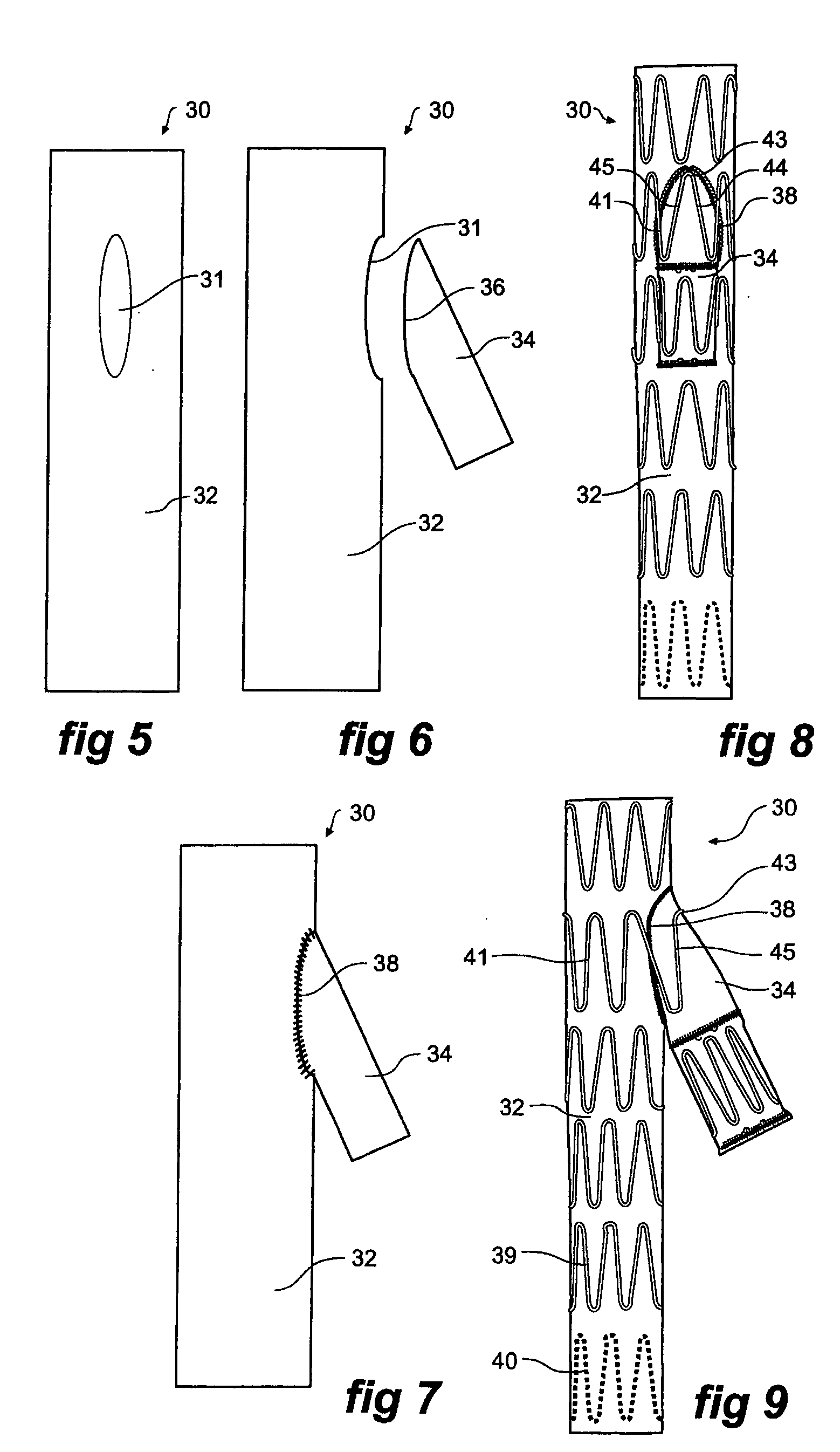 Side branch stent graft