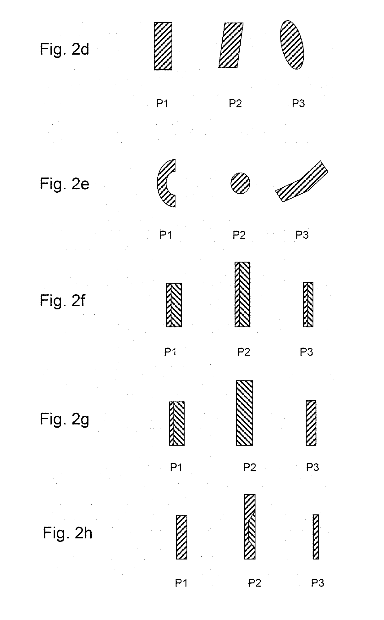 Orthodontic shape memory band