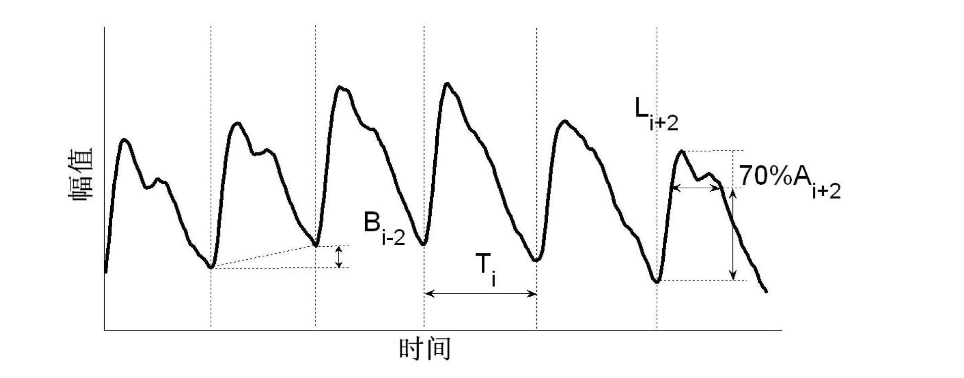 Pulse wave acquisition quality real-time analysis device