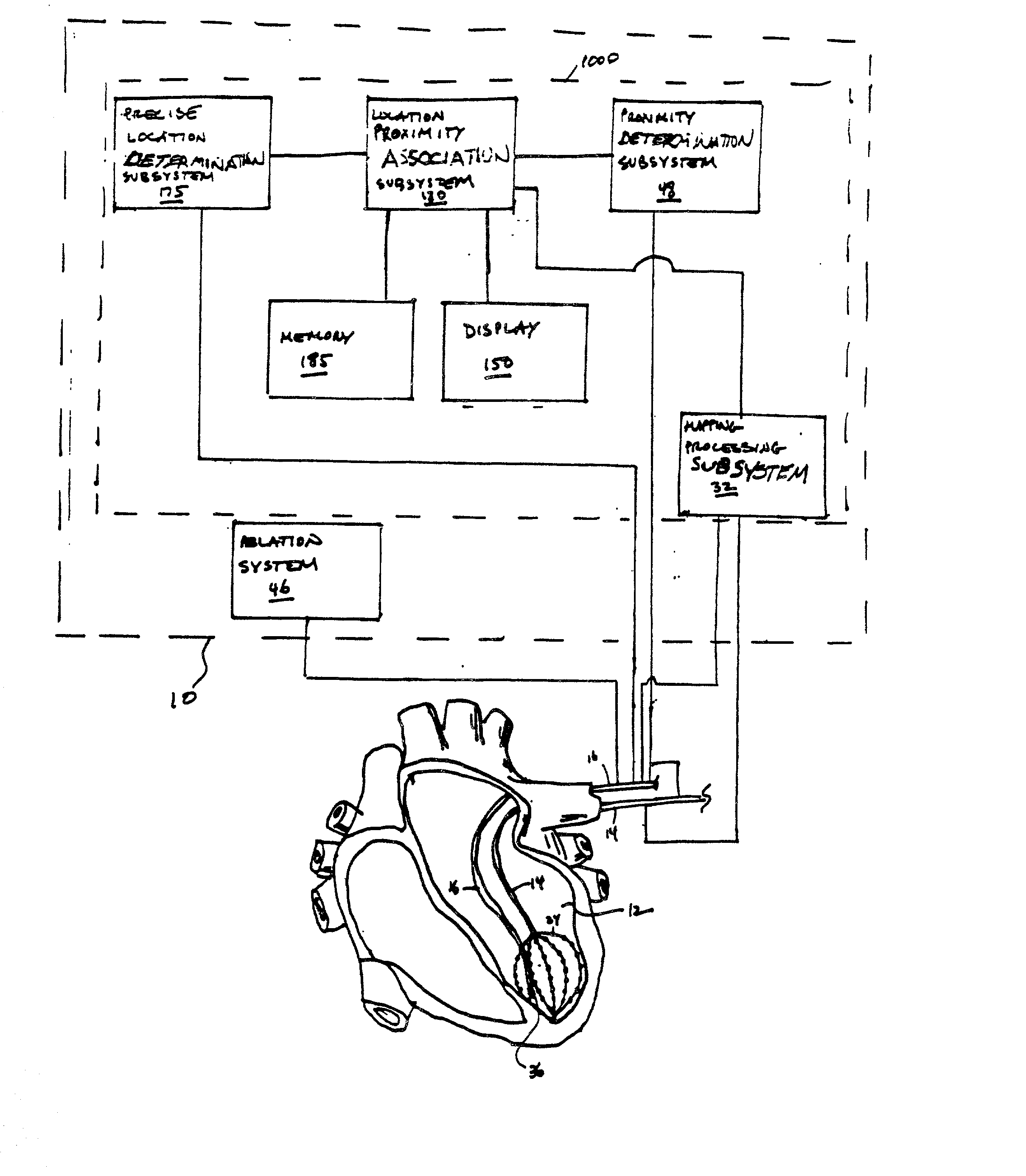 Systems and processes for refining a registered map of a body cavity