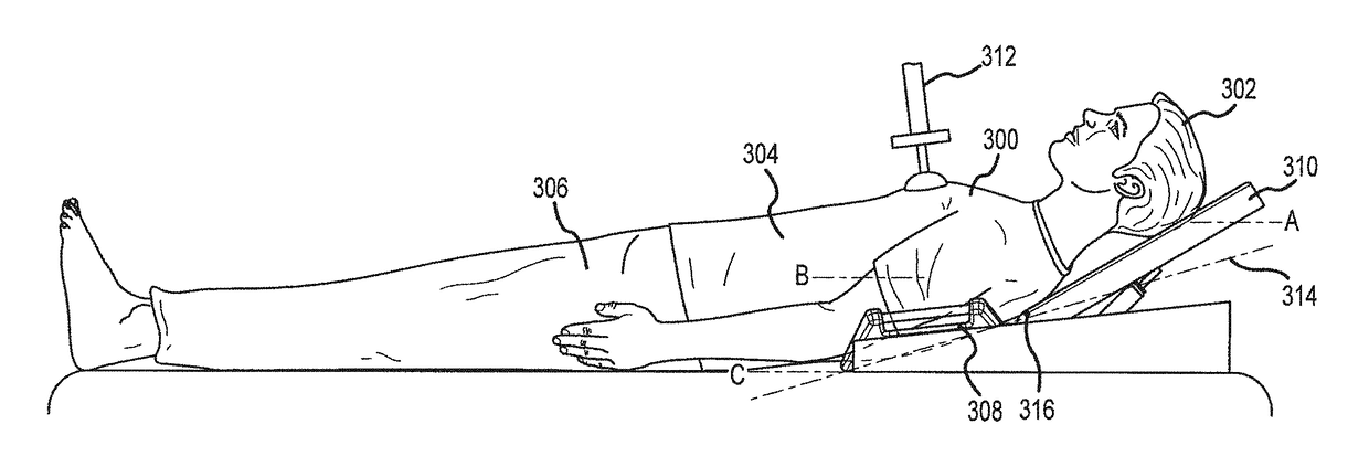 Support devices for head up cardiopulmonary resuscitation