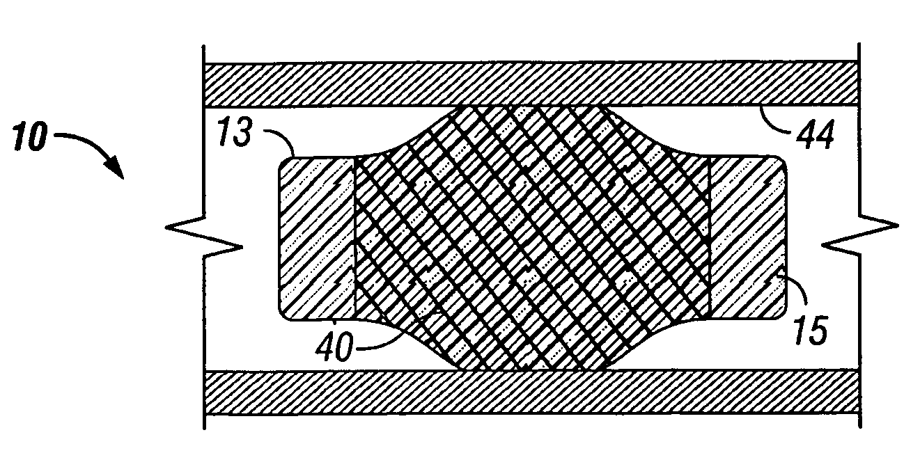 Expandable packer