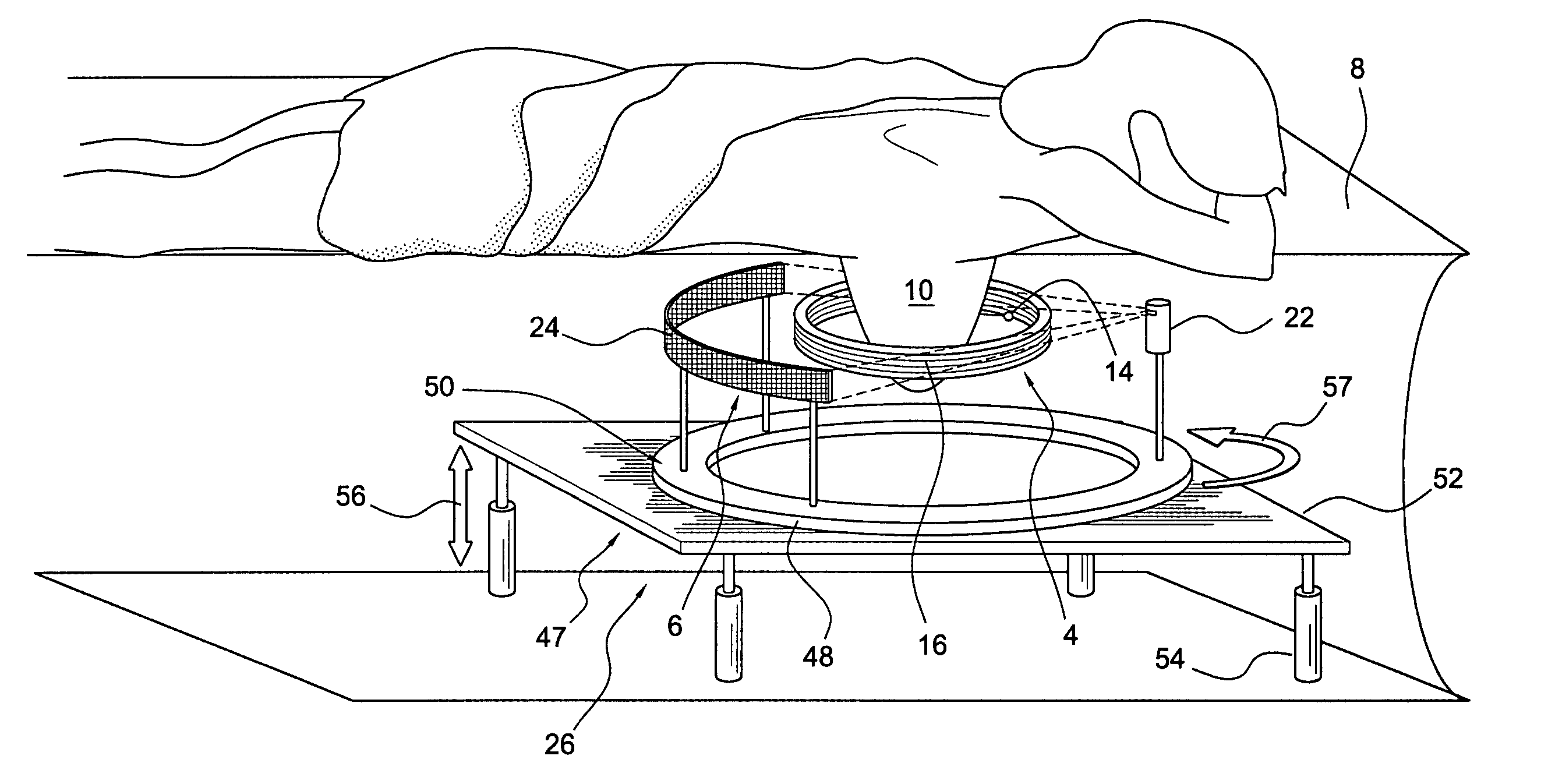 Apparatus and method to acquire data for reconstruction of images pertaining to functional and anatomical structure of the breast