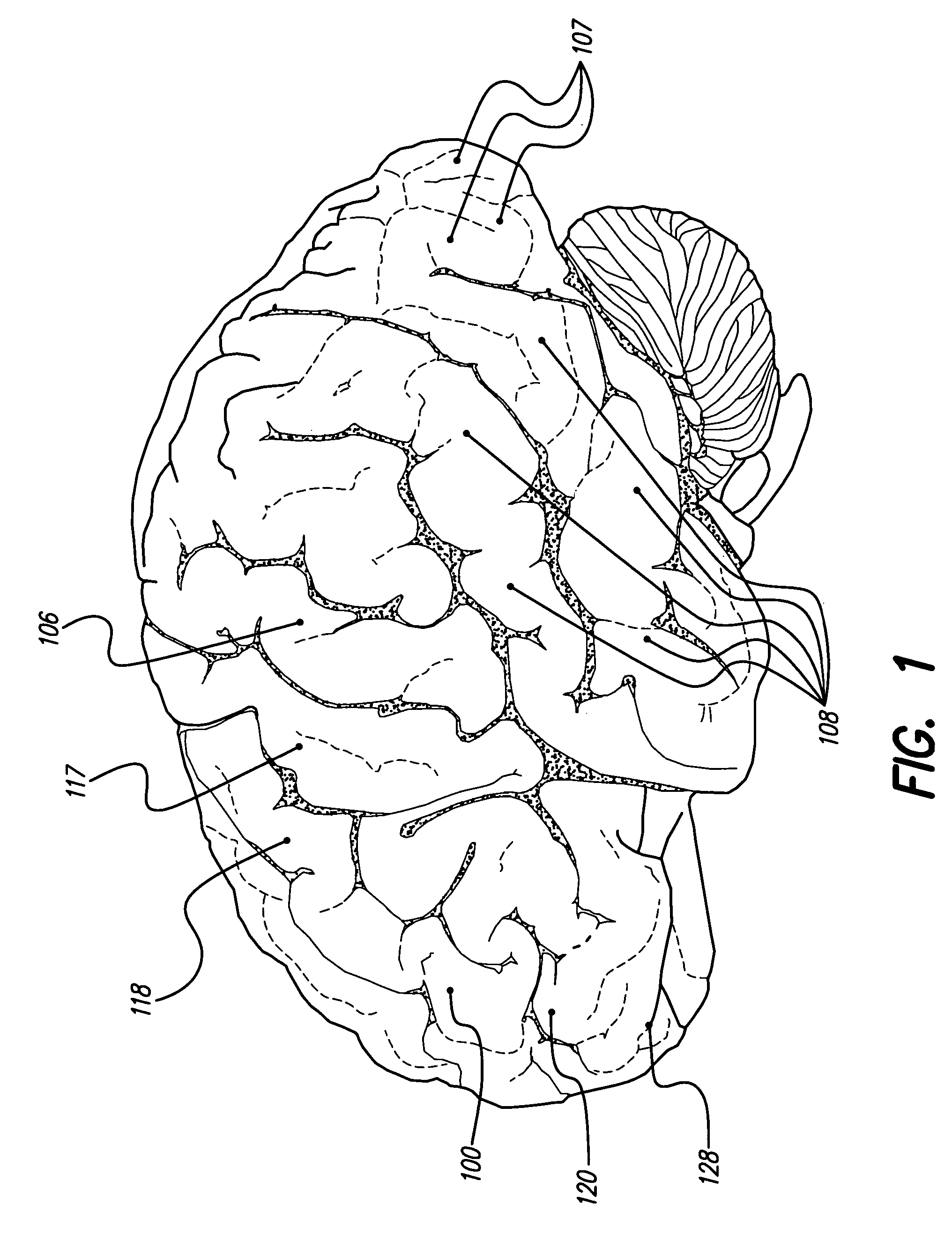 Treatment of mood and/or anxiety disorders by electrical brain stimulation and/or drug infusion