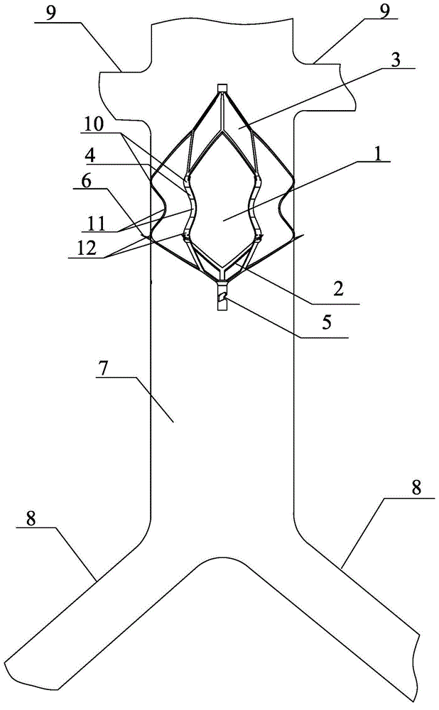 Filter capable of recycling thrombi