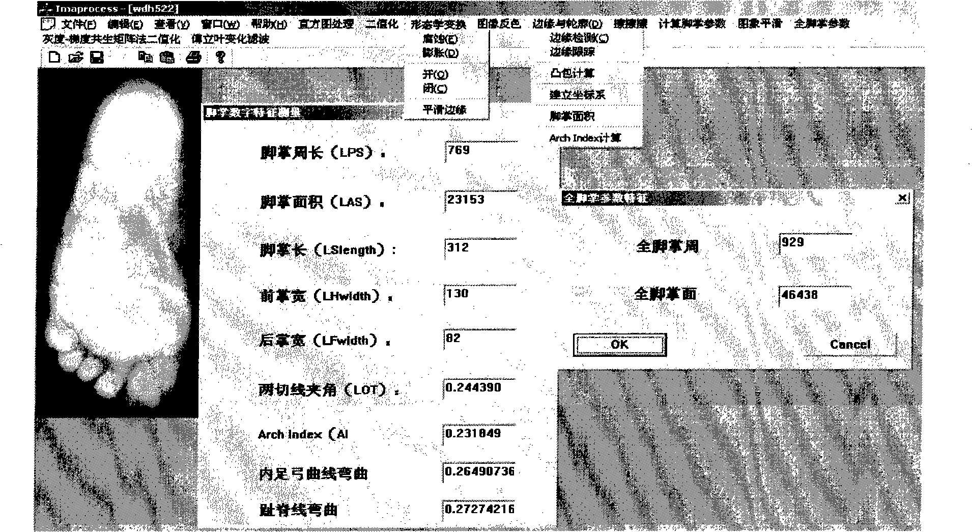 Method for extracting morphologic characteristic of human body bare footprint feature