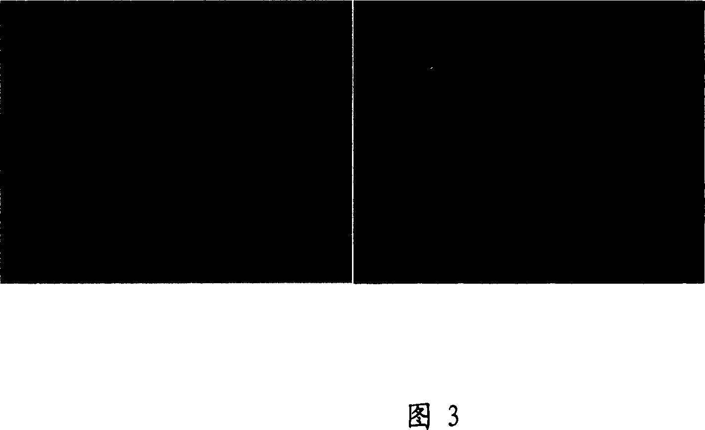 Recombination expression carrier for treating Aids, reformed blood building stem cell and method