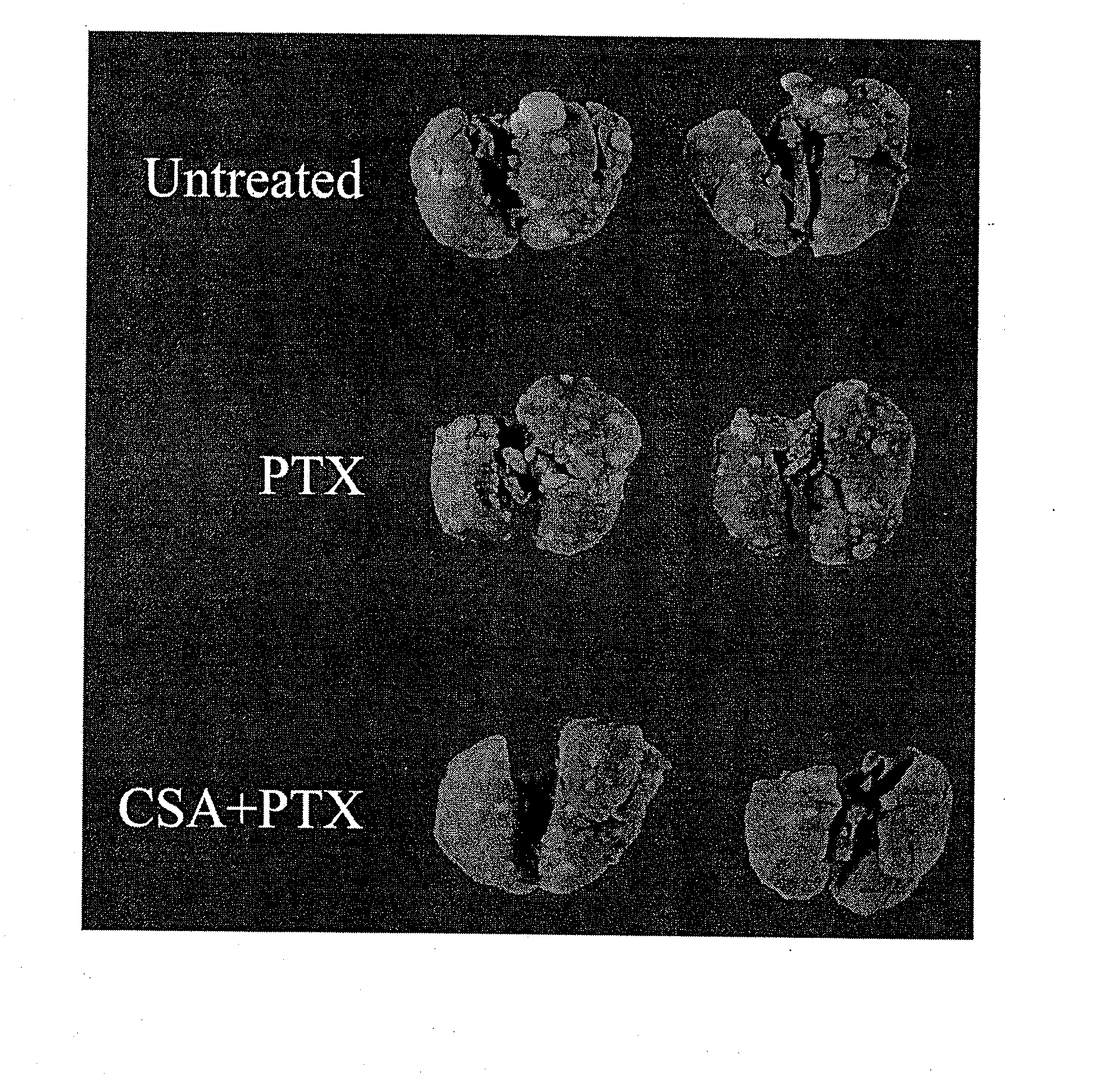 Aerosol Drug Inhibition of Lung Cancer