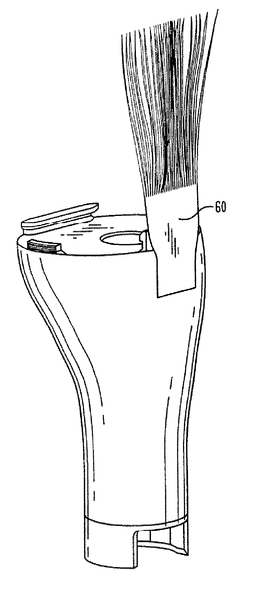 Prosthesis Having A Soft Tissue Attachment Element