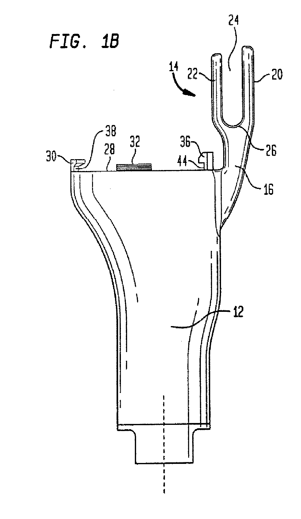 Prosthesis Having A Soft Tissue Attachment Element