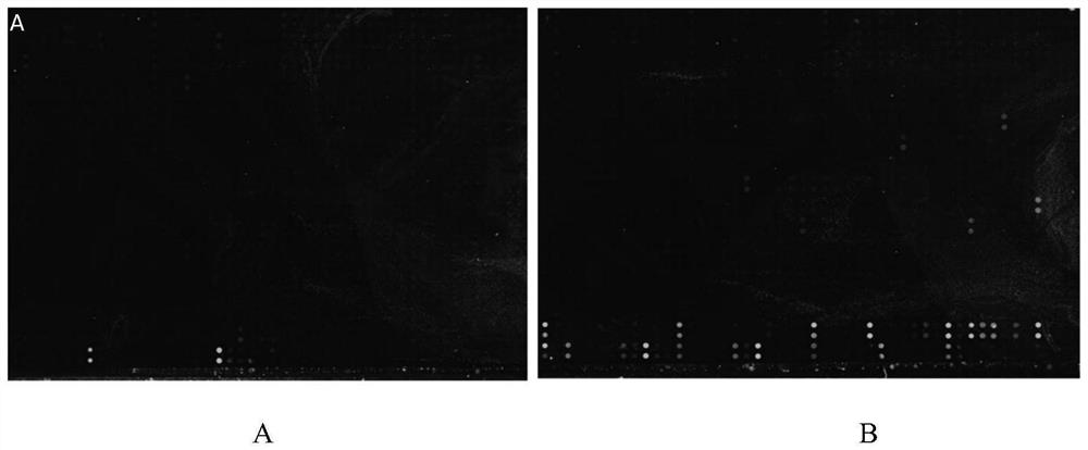 Polypeptide chip and application thereof in virus detection