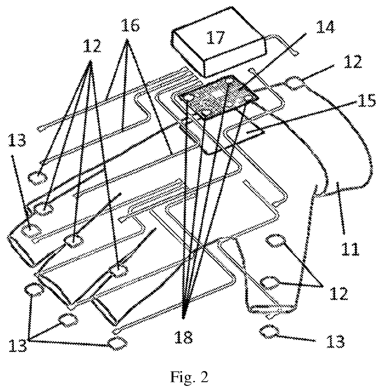 Hardware/software system for the rehabilitation of patients with cognitive impairments of the upper extremities after stroke