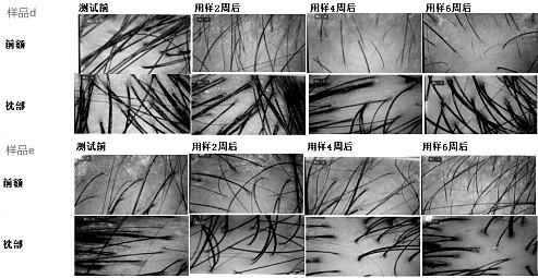 Microcapsule Chinese herbal medicine composition capable of inhibiting bacteria, resisting inflammation and promoting blood circulation, and preparation method for microcapsule Chinese herbal medicine composition