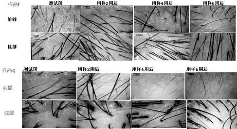 Microcapsule Chinese herbal medicine composition capable of inhibiting bacteria, resisting inflammation and promoting blood circulation, and preparation method for microcapsule Chinese herbal medicine composition