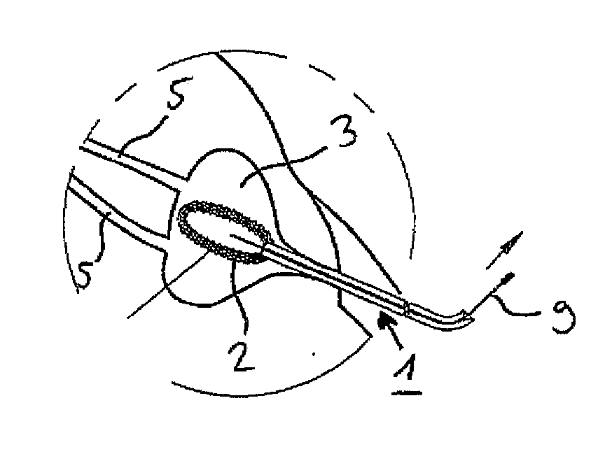 Device for protecting and cleaning the bladder lumen