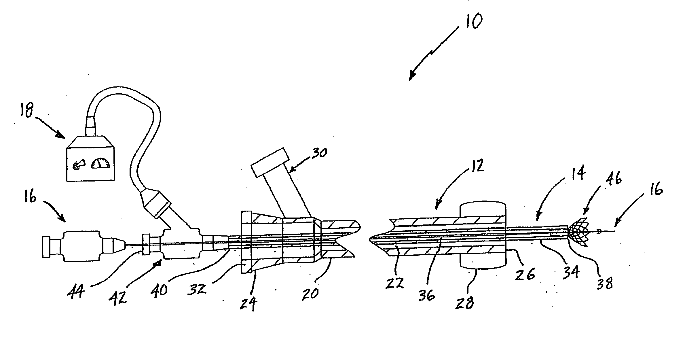 System and method for treating ischemic stroke