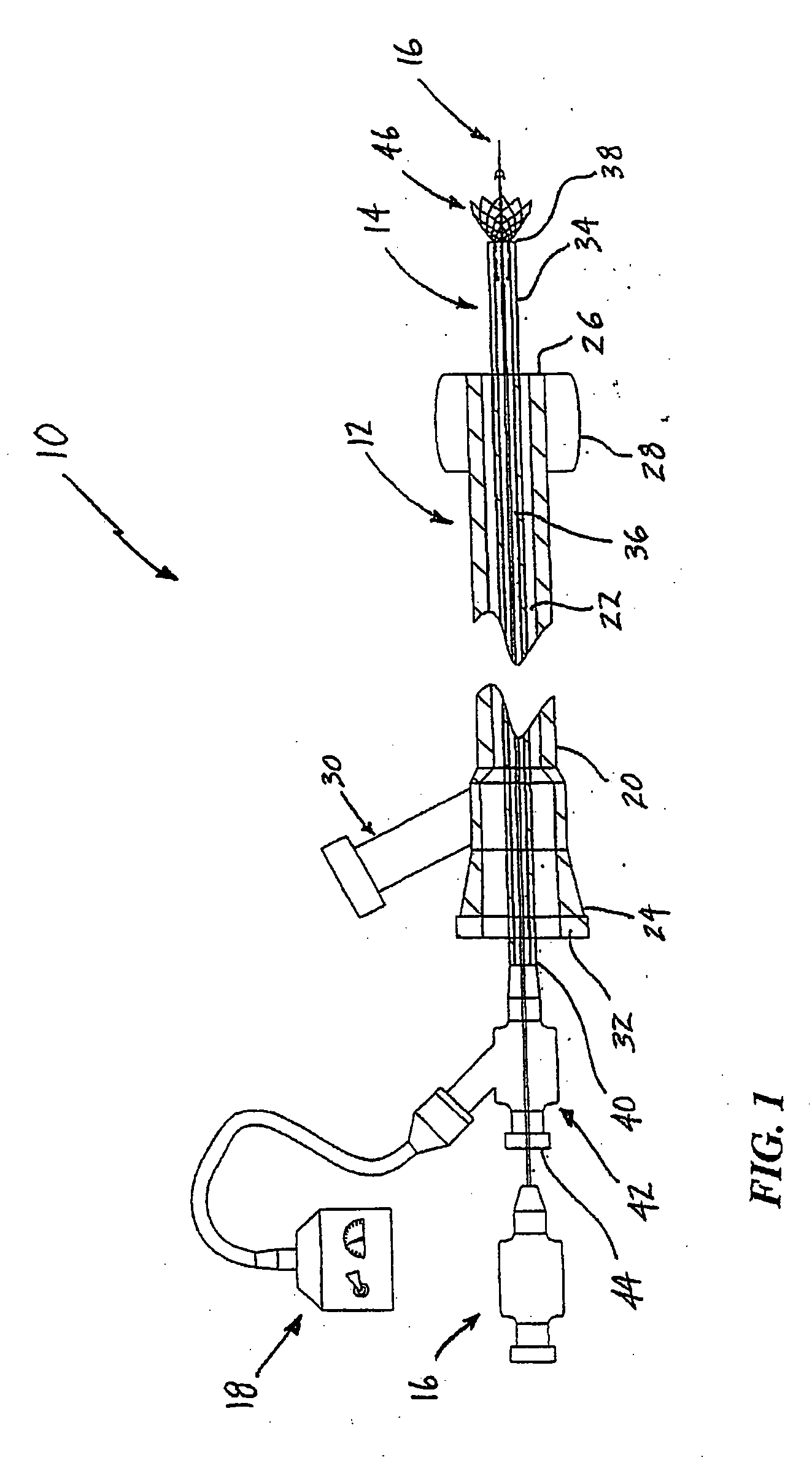 System and method for treating ischemic stroke