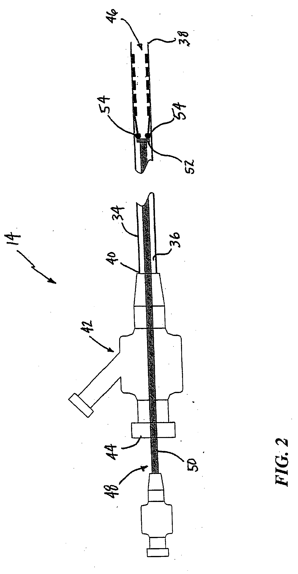 System and method for treating ischemic stroke