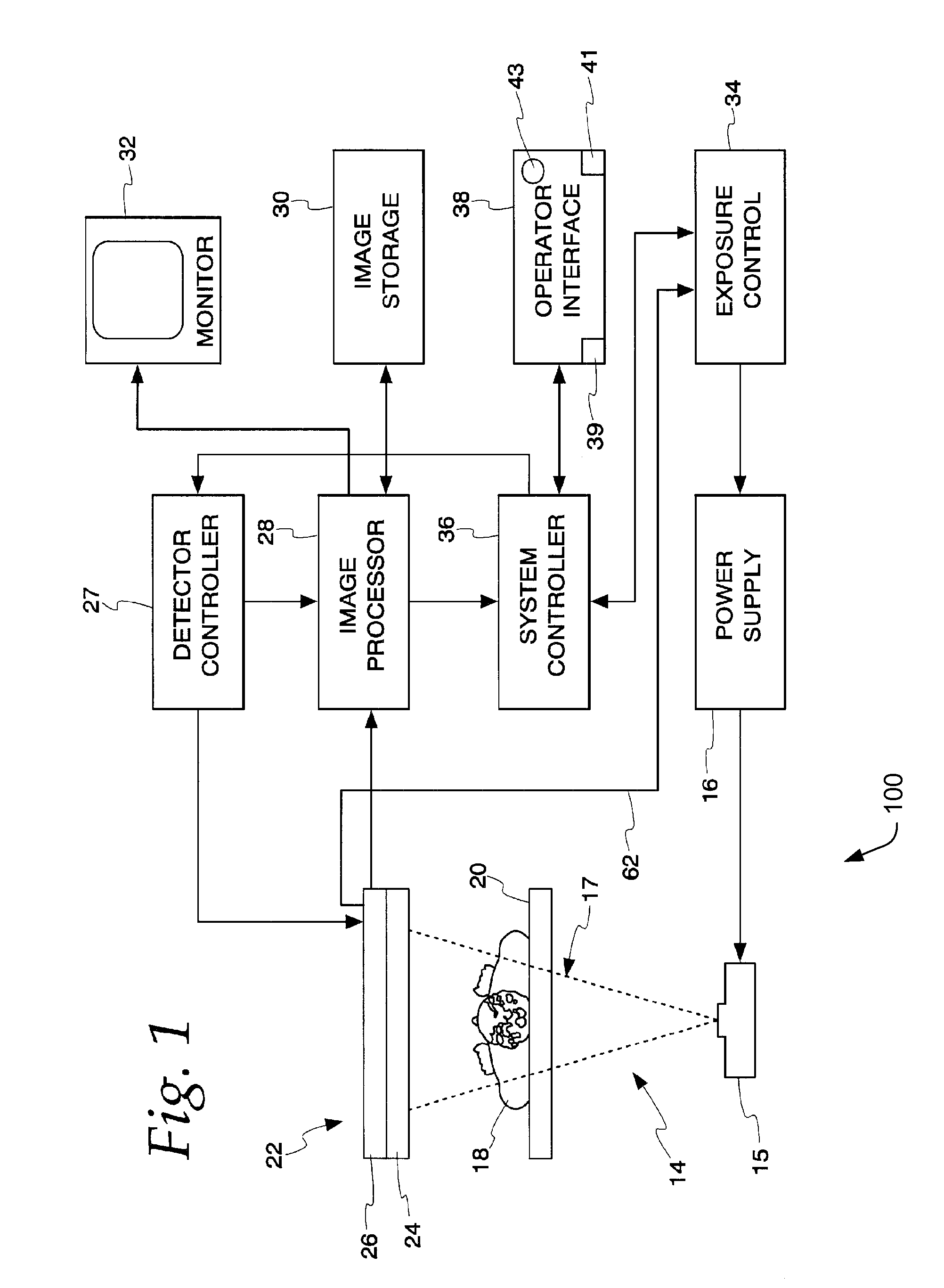 System and method for flattened anatomy for interactive segmentation and measurement