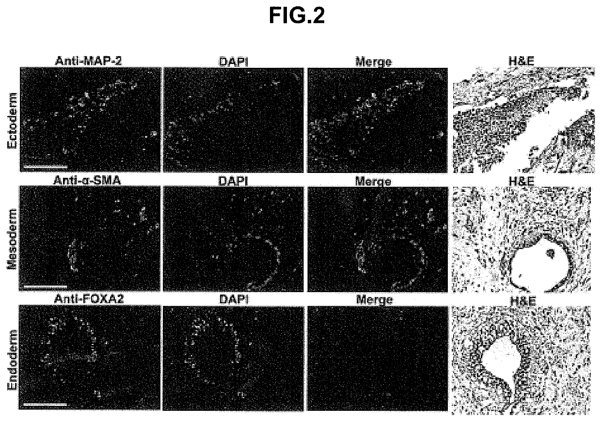 Beta-2 microglobulin-deficient cells