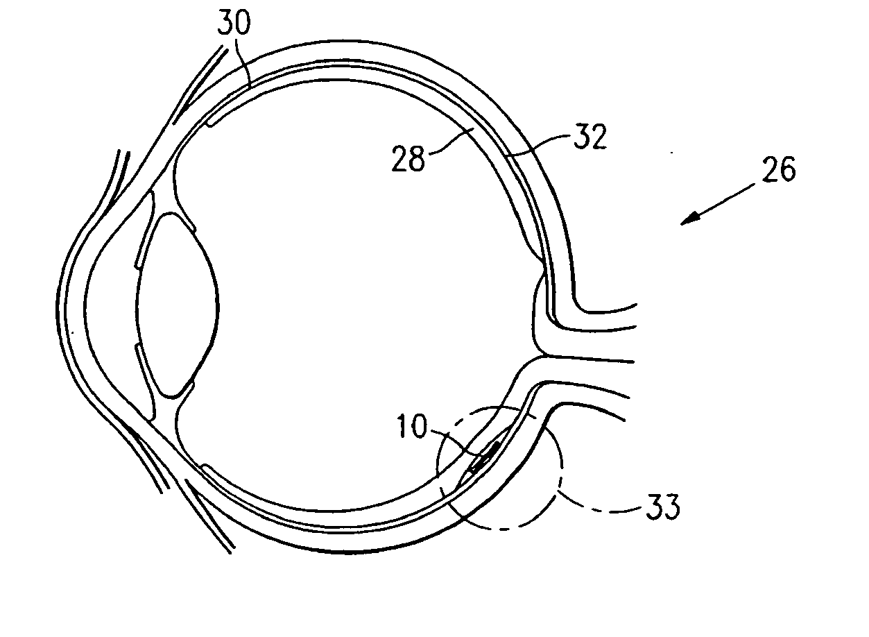 Microfabricated tissue as a substrate for pigment epithelium transplantation