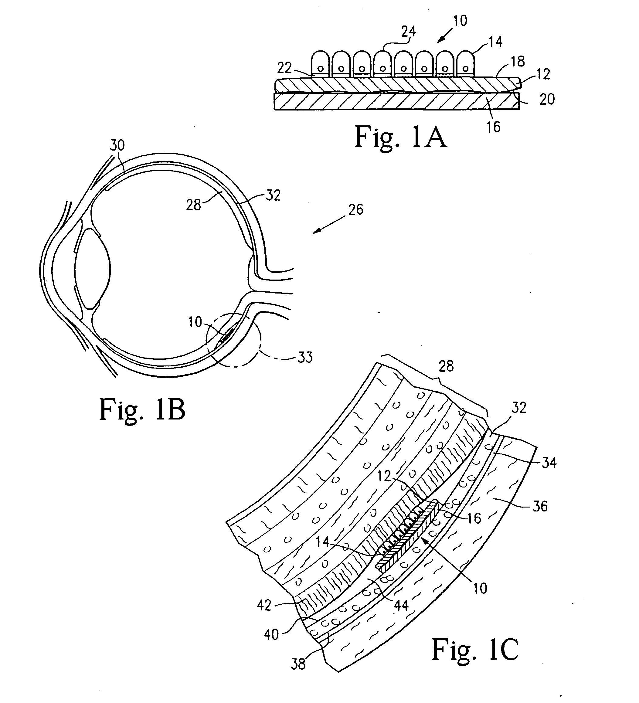 Microfabricated tissue as a substrate for pigment epithelium transplantation