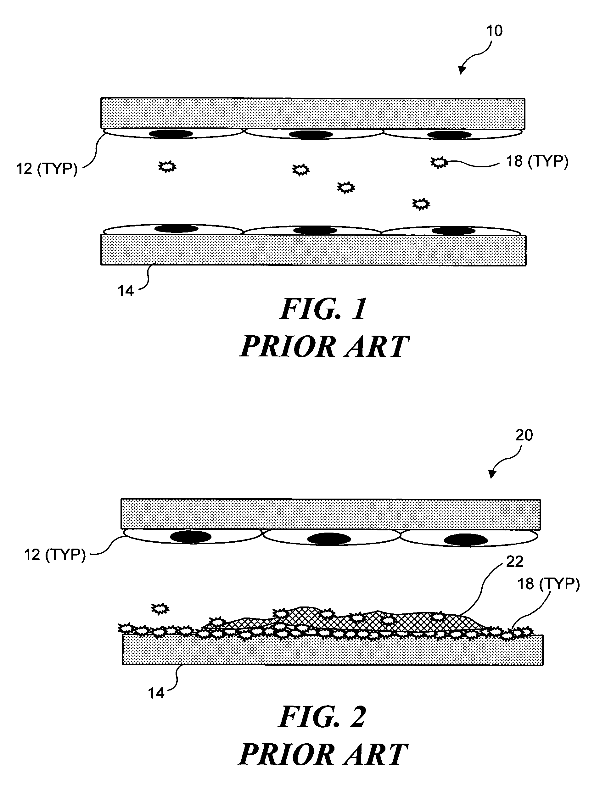 Ultrasound target vessel occlusion using microbubbles