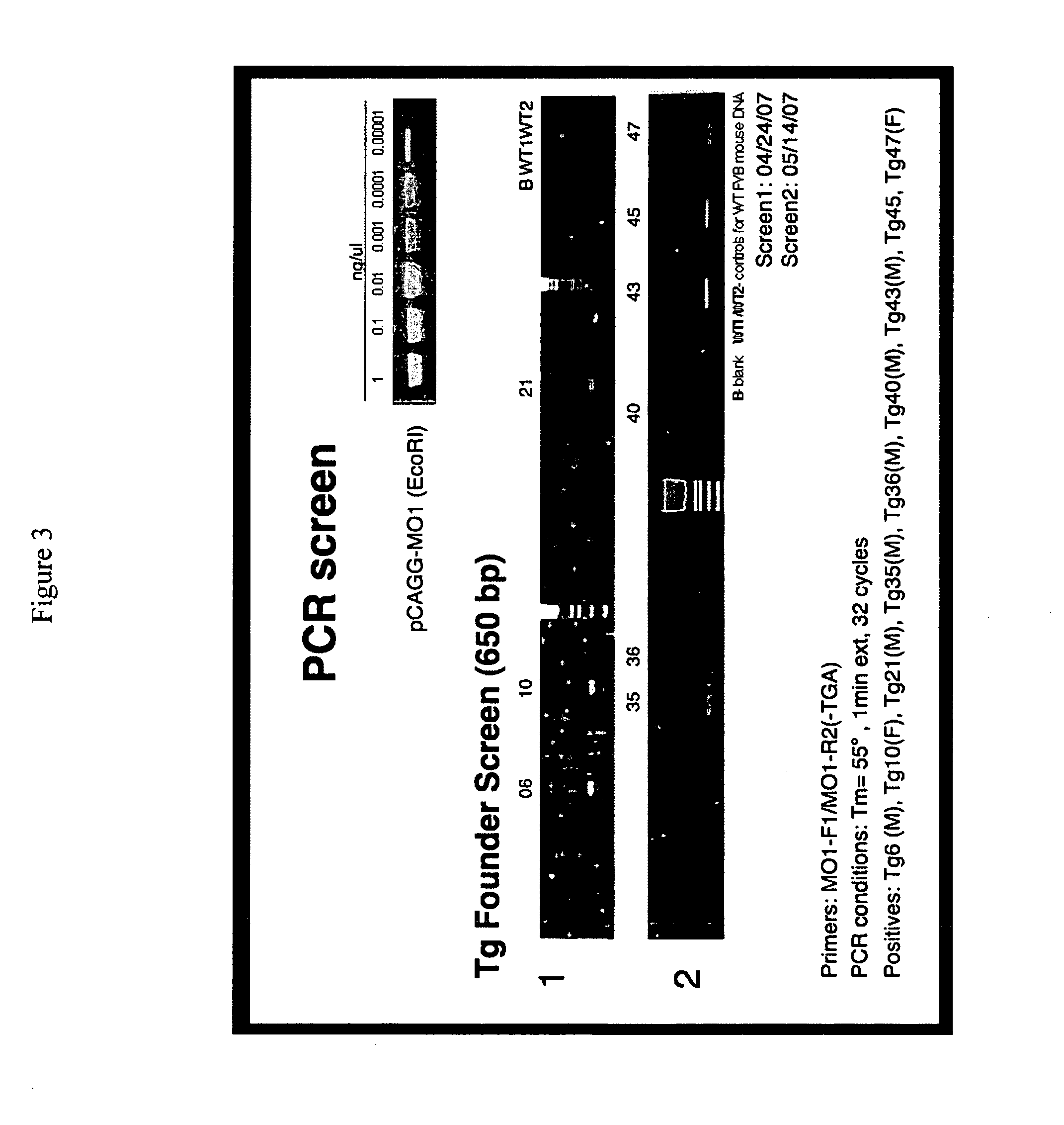 MO-1, A Gene Associated With Morbid Obesity