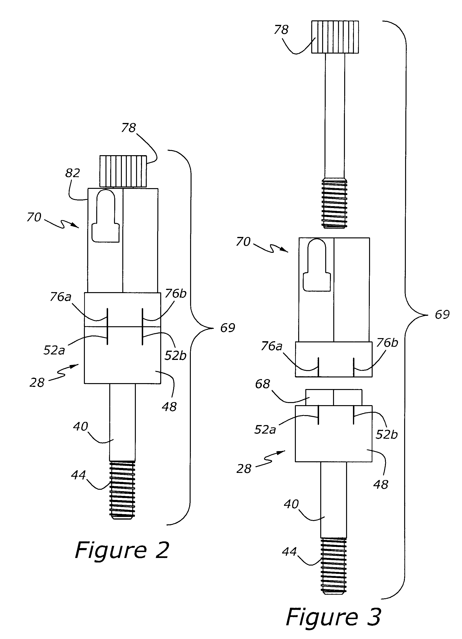 Method for fabricating an implanted dental restoration