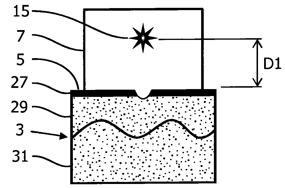 Skin treatment system and method