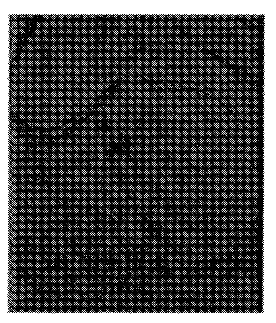 System and method for multi-image based stent visibility enhancement