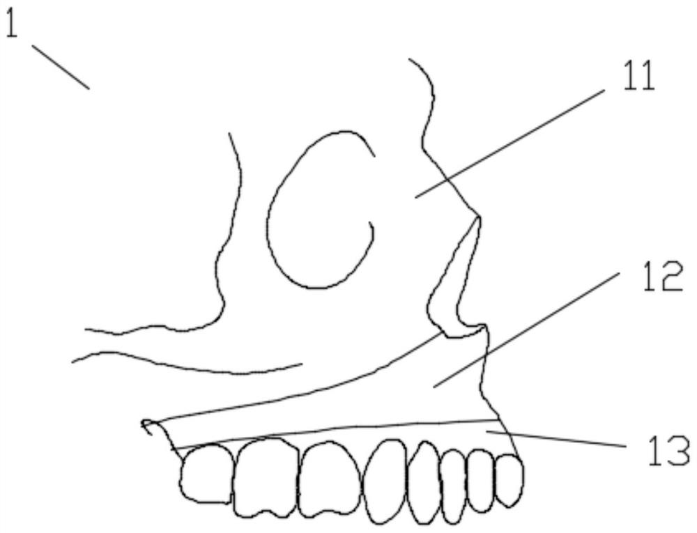 Orthognathic surgery teaching mold and use method thereof