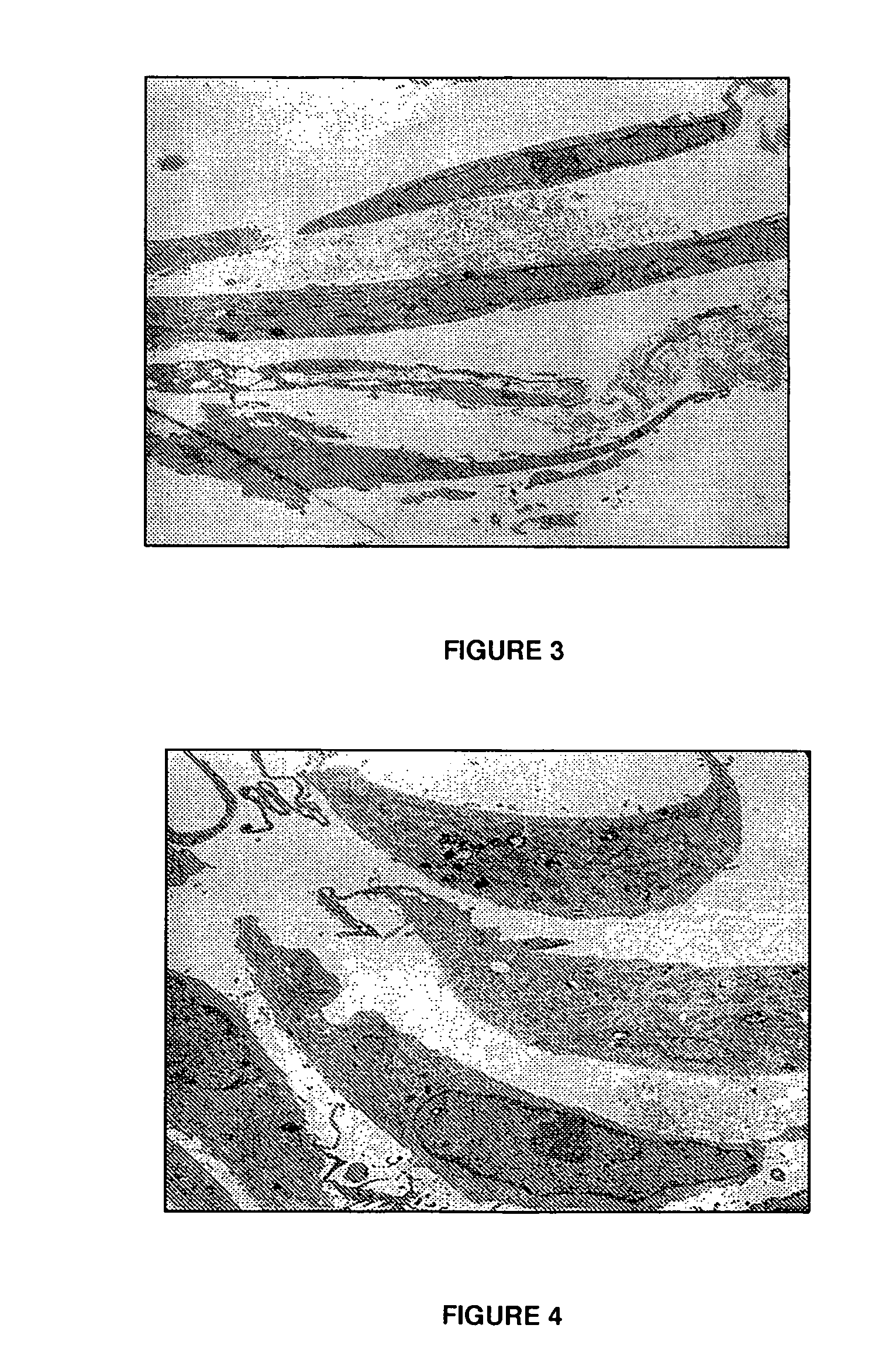 Disacchrides for the treatment of tendons, ligaments, and bones