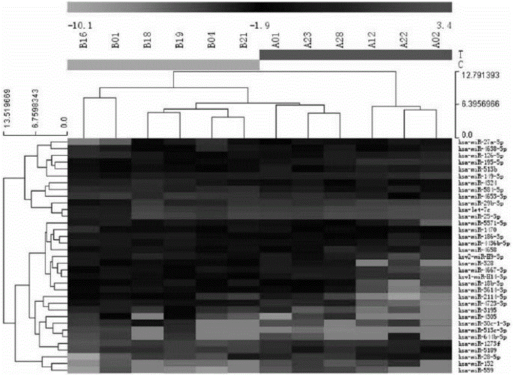 Application of circulating miRNA in serving as age-related macular degeneration diagnostic markers