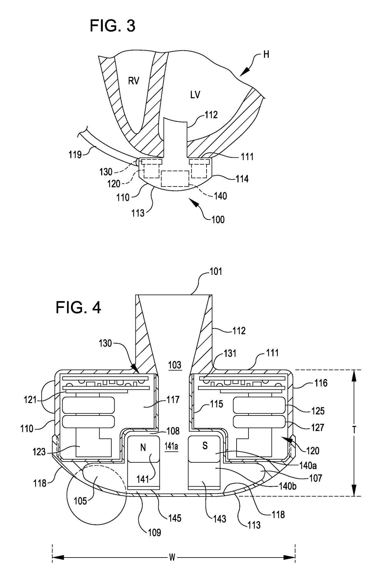 Methods and systems for providing battery feedback to patient