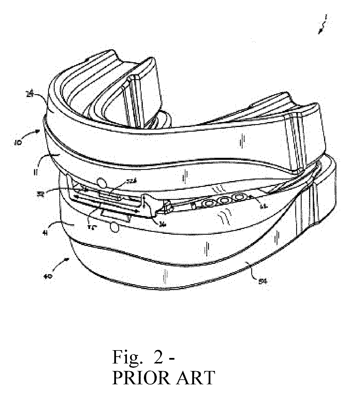 Non-Invasive Handling of Sleep Apnea, Snoring and Emergency Situations