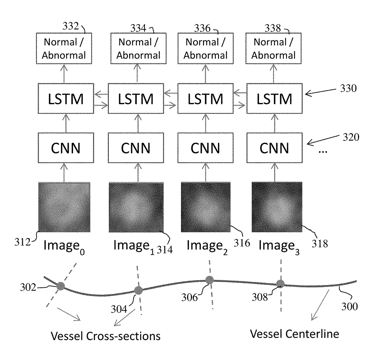 Method and System for Vascular Disease Detection Using Recurrent Neural Networks