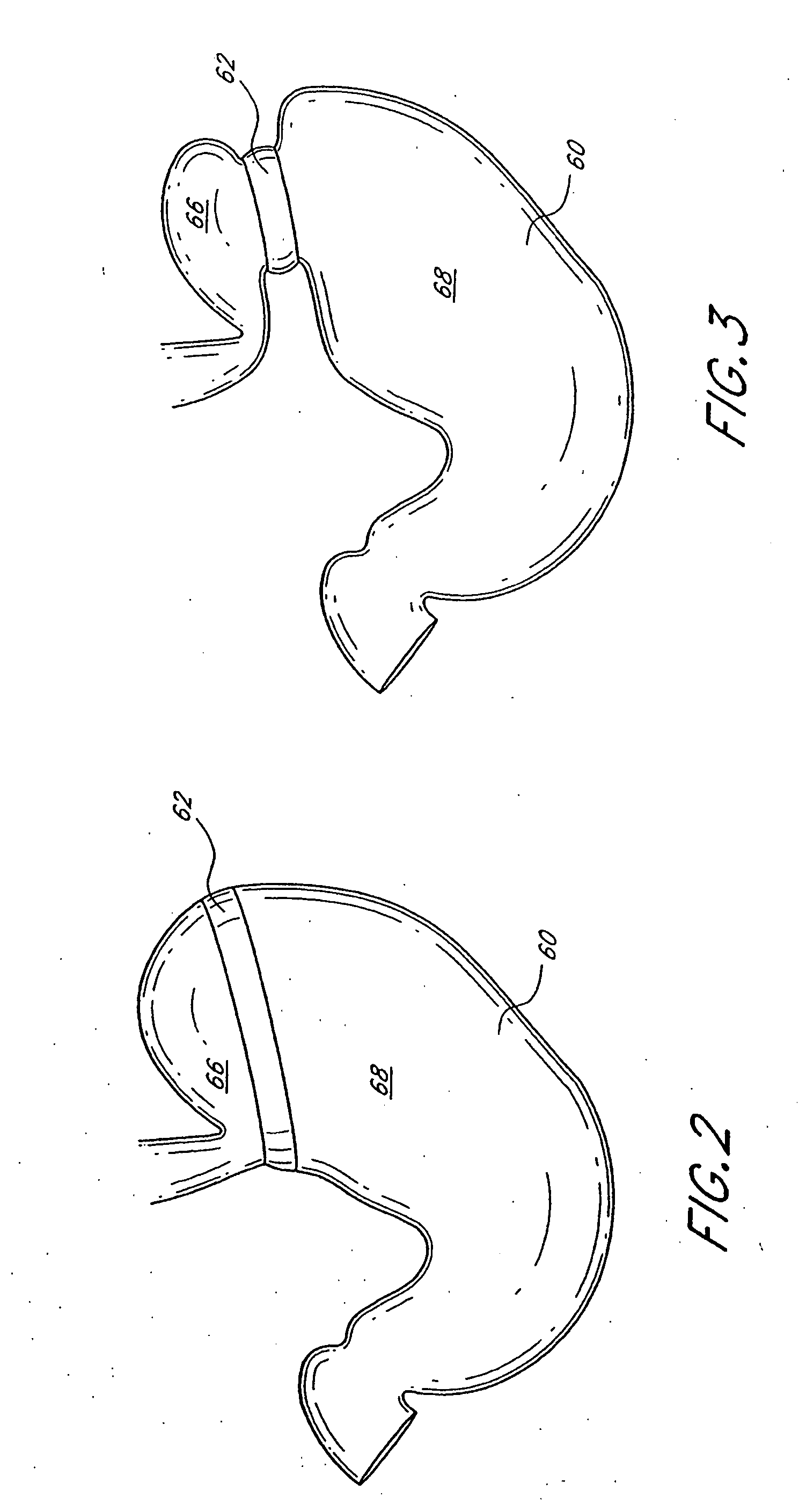 Dynamically adjustable gastric implants