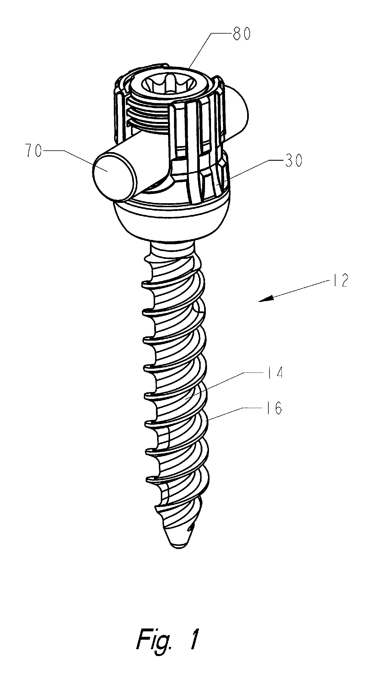 Locking polyaxial ball and socket fastener