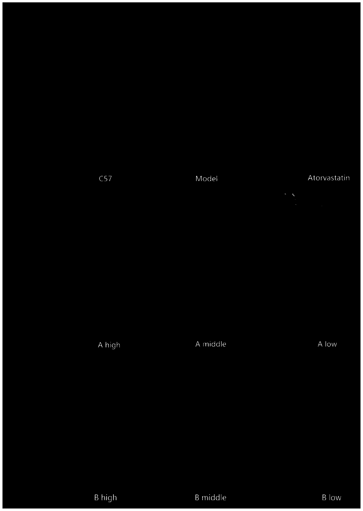 Application of sodium hydrogen sulfite andrographolide in preparation of promoter for promoting reverse transport of cholesterol