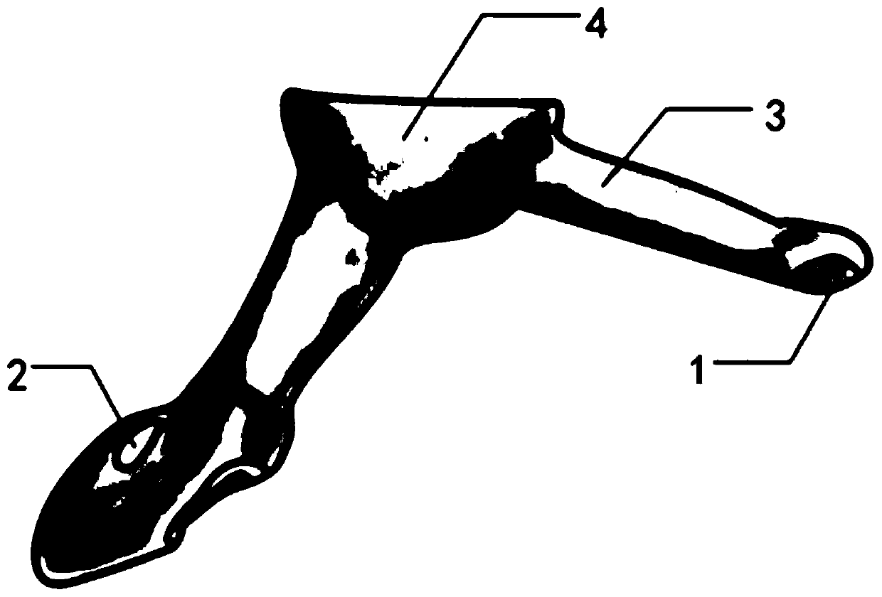 3D printing semi-pelvic prosthesis