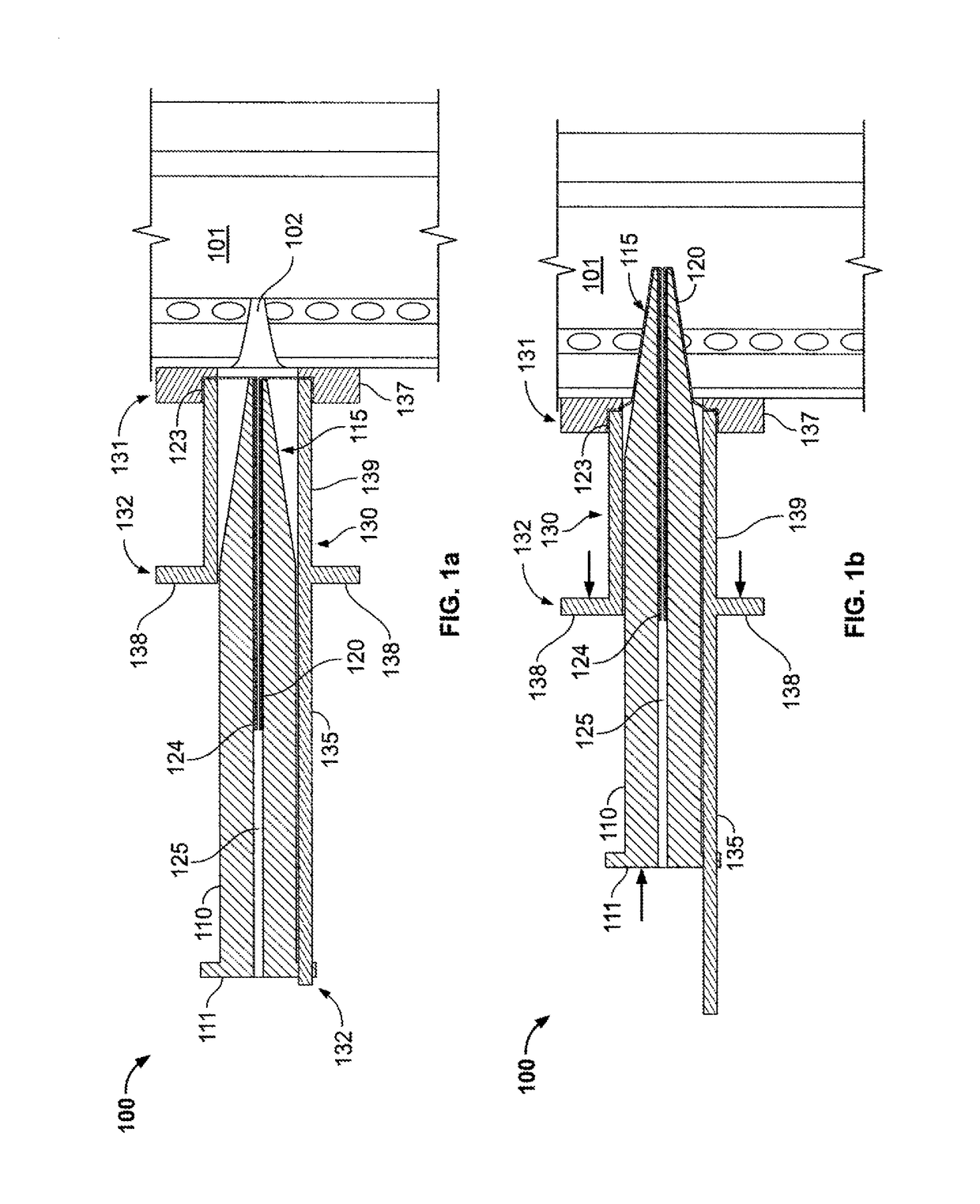 Everting device and method for tracheostomy