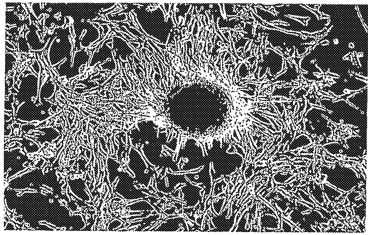 Isolation and therapeutic application of adult retinal stem cells collected from extra-retinal tissues